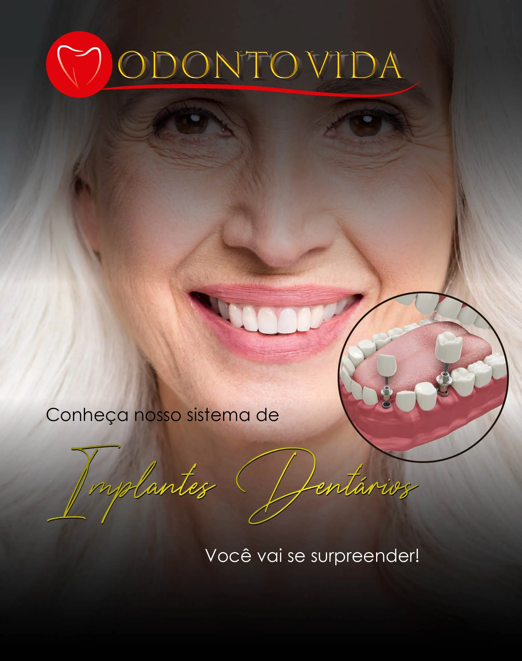 Banner implantes mobile-01